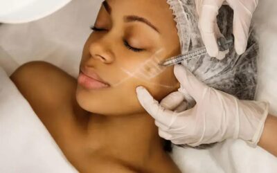 Botox para levantar sobrancelha: o segredo da beleza em Campo Limpo Paulista